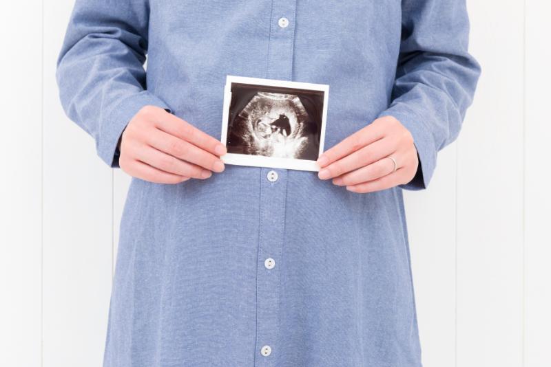 エコー写真を持つ妊婦